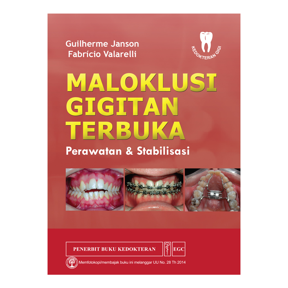 Maloklusi Gigitan Terbuka Perawatan & Stabilisasi