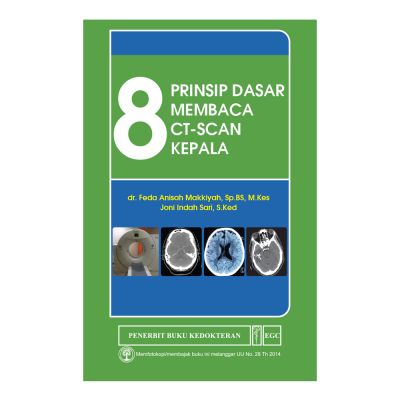 8 Prinsip Dasar Membaca CT-Scan Kepala