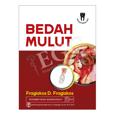 Bedah Mulut