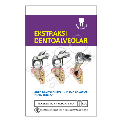 Ekstraksi Dentoalveolar