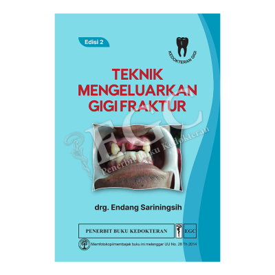 Teknik Mengeluarkan Gigi Fraktur ed.2