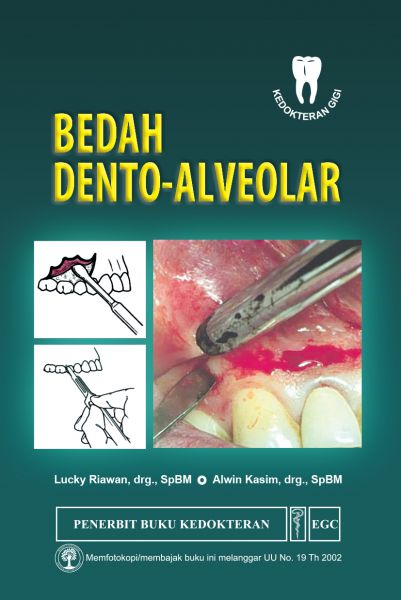 Bedah Dento-Alveolar