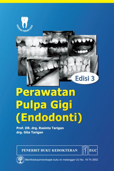 Perawatan Pulpa Gigi Endodonti Ed.3