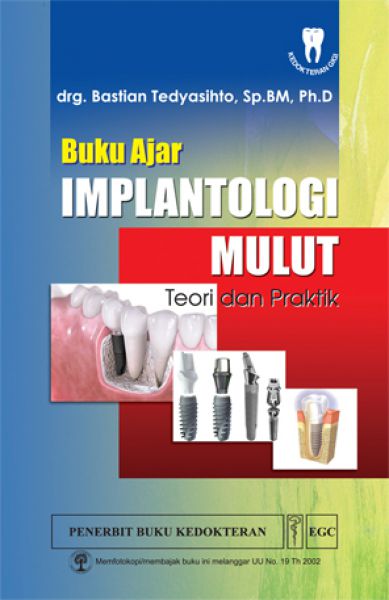 Buku Ajar Implantologi Mulut: Teori & Praktik