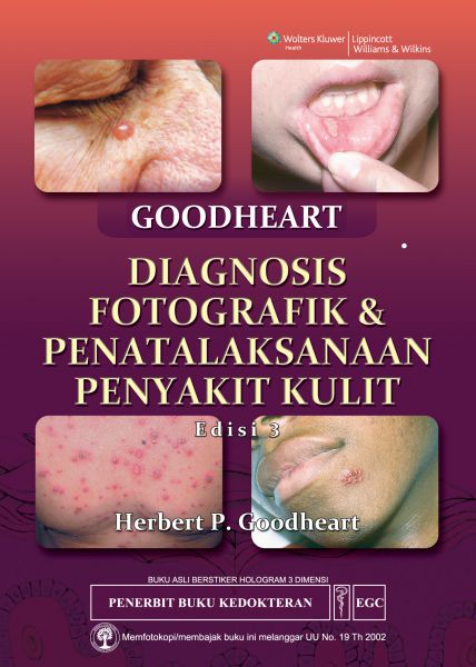 Goodheart Diagnosis Fotografik & Penatalaksanaan Penyakit Kulit Edisi 3