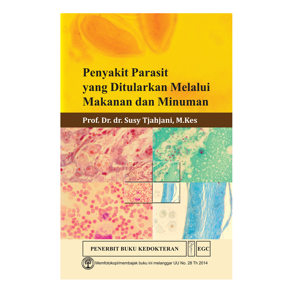 Penyakit Parasit yang Ditularkan Melalui Makanan dan Minuman